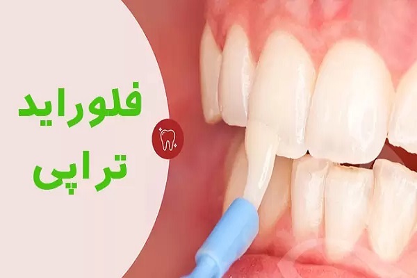 فلوراید تراپی